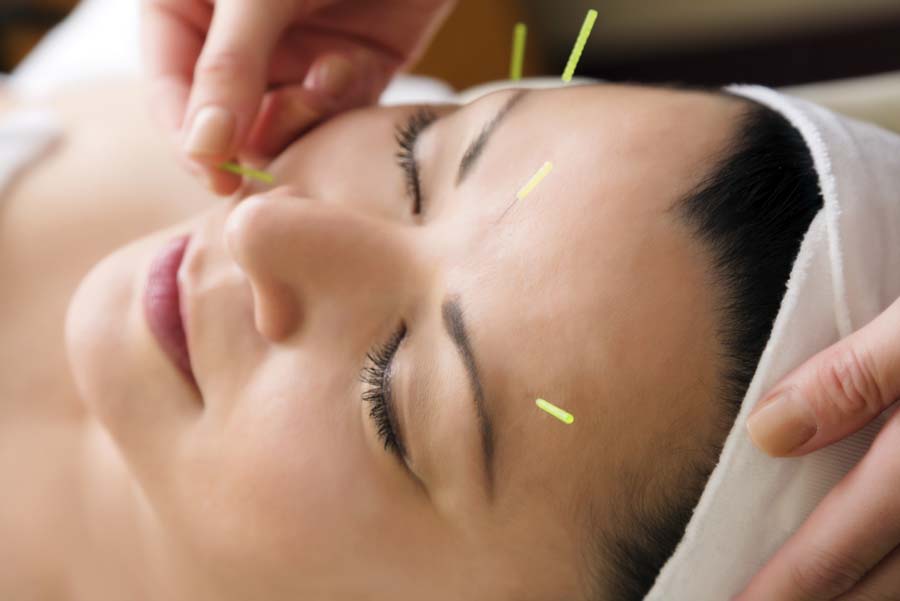 cosmetic acupuncture