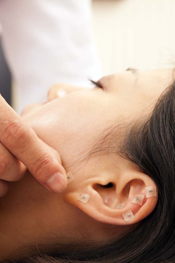 ear acupuncture seeds